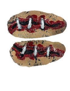 Widmann SRL Open wond klein met nietjes