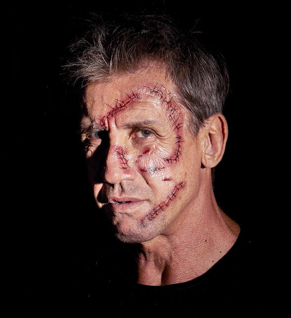 Widmann SRL 10 Tattoos met nietjes en hechtingen