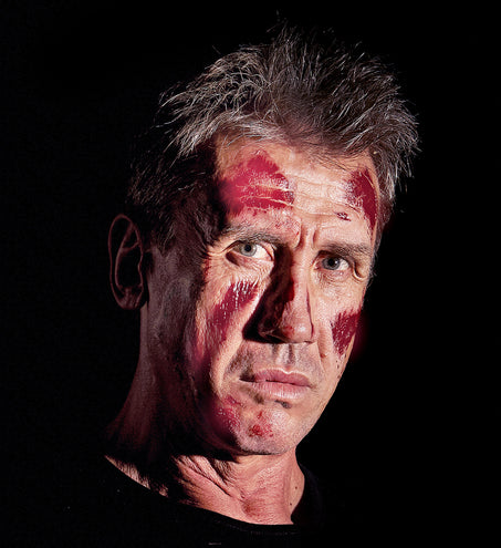 Widmann SRL 6 Brandwond tattoo nep