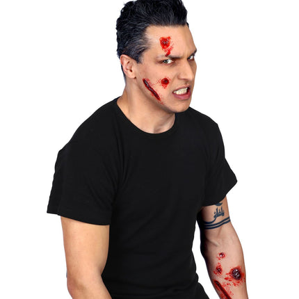 Widmann SRL Nep brand-wonden-set