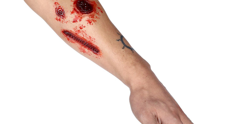 Widmann SRL Nep brand-wonden-set