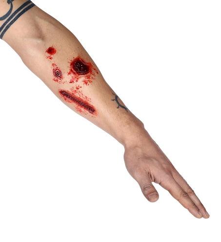 Widmann SRL Nep brand-wonden-set