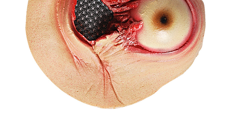 Widmann SRL Nep wonden uitpuilend oog