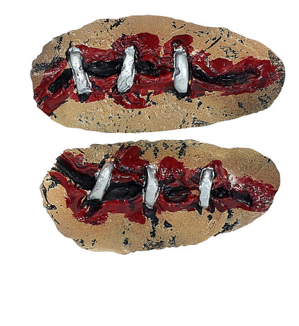 Widmann SRL Open wond klein met nietjes