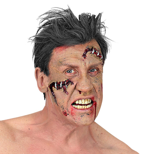 Widmann SRL Open wond klein met nietjes