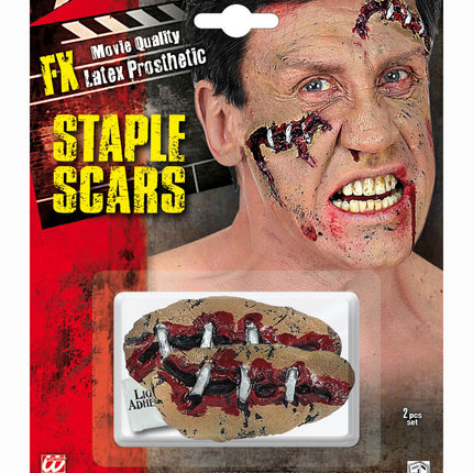 Widmann SRL Open wond klein met nietjes